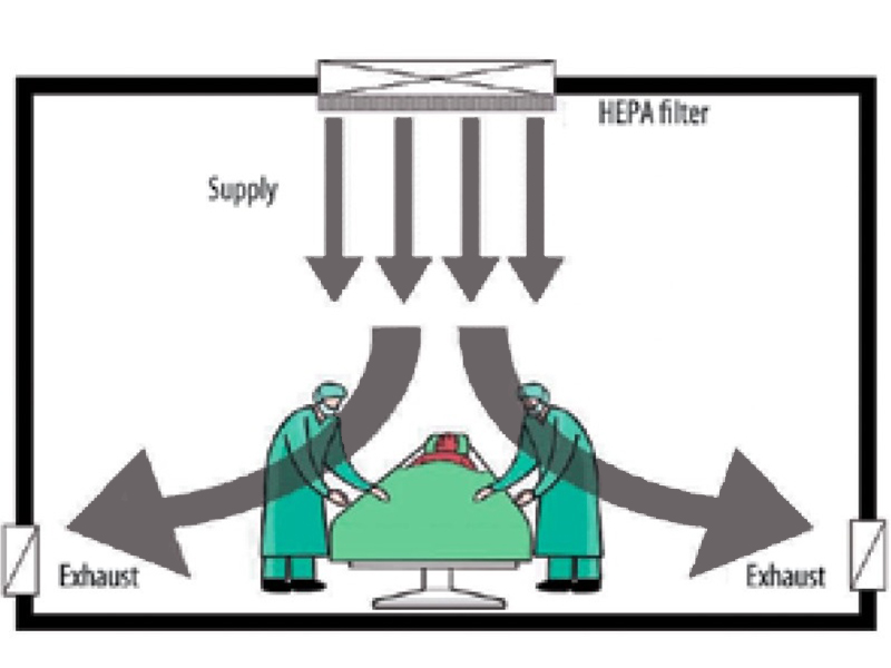 بهترین نوع سیستم تهویه در اتاق عمل